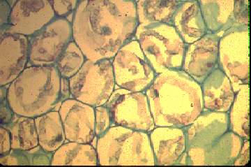 cross-section of red gall of pinyon needles at 170 x